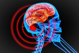 Mybroadband Radiation Brain Cellphone - courtesy Wiki